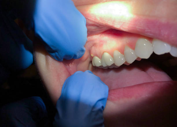 Best Emergency Cosmetic Dentistry in Gulf Hills, MS