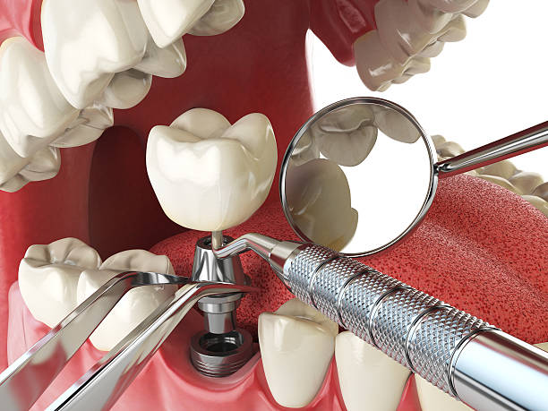 Best Emergency Dental Services for Seniors in Gulf Hills, MS